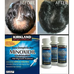 Produtos de crescimento rápido de cabelo natural prevenção de queda de cabelo na internet