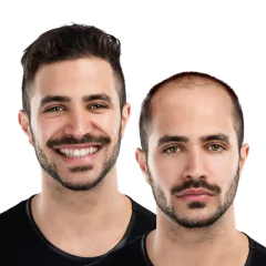 Produtos de crescimento rápido de cabelo natural prevenção de queda de cabelo - Temos tudo