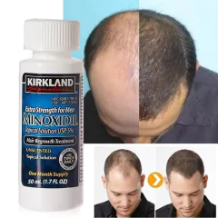 Produtos de crescimento rápido de cabelo natural prevenção de queda de cabelo