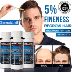 Produtos de crescimento rápido de cabelo natural prevenção de queda de cabelo