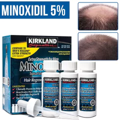 Produtos de crescimento rápido de cabelo natural prevenção de queda de cabelo - comprar online