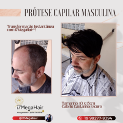 PRÓTESE CAPILAR MASCULINA CONFECÇÃO BRASILEIRA PERSONALIZADA (PROMOÇÃO DE LANÇAMENTO!!) - comprar online