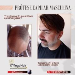 PRÓTESE CAPILAR MASCULINA CONFECÇÃO BRASILEIRA PERSONALIZADA (PROMOÇÃO DE LANÇAMENTO!!) na internet