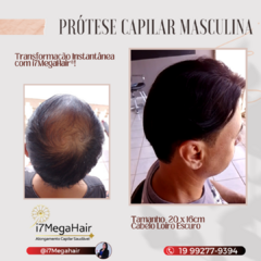 PRÓTESE CAPILAR MASCULINA CONFECÇÃO BRASILEIRA PERSONALIZADA (PROMOÇÃO DE LANÇAMENTO!!)