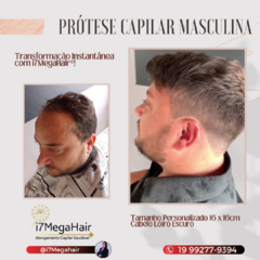 Imagem do PRÓTESE CAPILAR MASCULINA CONFECÇÃO BRASILEIRA PERSONALIZADA (PROMOÇÃO DE LANÇAMENTO!!)