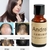 Venda imperdível 20 ml de óleos essenciais à base de ervas, queratina, crescimento rápido, essência, líquido, perda