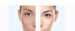 Clareador Facial Para Manchas Escuras na internet
