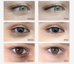 Retinol Removedor de Rugas Creme para o Rosto Creme para os Olhos Antienvelhecim na internet