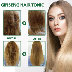 Ouhoe poderoso crescimento do cabelo óleo evitar a perda de cabelo produtos - loja online