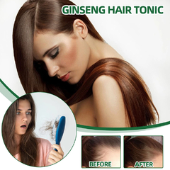 Ouhoe poderoso crescimento do cabelo óleo evitar a perda de cabelo produtos