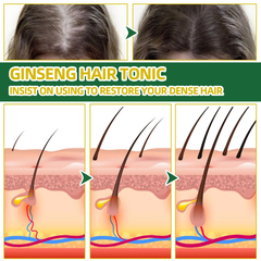 Ouhoe poderoso crescimento do cabelo óleo evitar a perda de cabelo produtos - Nordic Shop