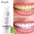 Limpeza dos dentes branqueamento mousse de dente remove manchas de dente essênc - ka store