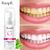 limpeza dos dentes branqueamento mousse de dente remove manchas de dente essênc