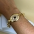 Imagem do Conjunto de Olho Resinado