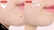 TIAM - AC Fighting Spot Rx Cream - Para el Acne 30ml - Moaio Beauty Skincare