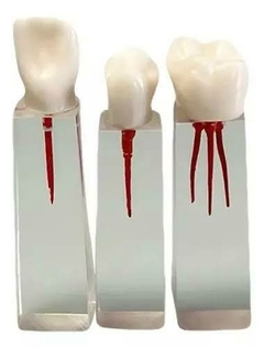 Dientes para Práctica de Endodoncia cubo con Corona
