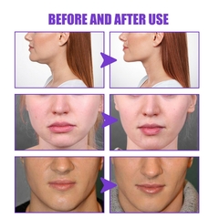 V-Shape Firming Face, Lift Slimming Creme, renova pele rosto na internet