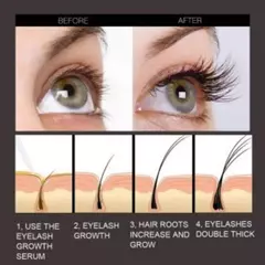 Alopecia-Tratamiento Capilar para Mujer - TOKO Directo a tu Puerta
