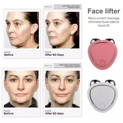 Rodillo Eléctrico para Estiramiento Facial ,Masajeador de Microcorriente EMS, Rejuvenecimiento de la Piel - comprar en línea
