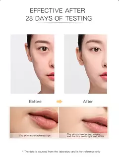 Imagen de Máscara de terapia de luz Led , cuidado de la piel, belleza, salud Facial, removedor de acné, antiarrugas.