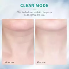 Masajeador Facial para el Cuidado de la Piel Facial - tienda en línea