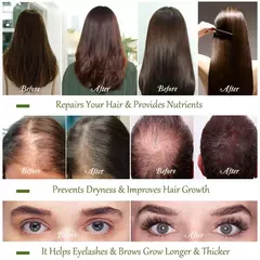 Imagen de Alopecia-Tratamiento Capilar para Mujer