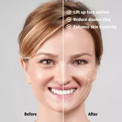 Dispositivo de Belleza de Lifting Facial , Adelgazante Facial , Mentón