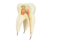 DENTE MOLAR SUPERIOR C/ RAIZ TRIPLA EM 3 PARTES, 8X O TAMANHO REAL APROX. - comprar online