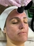 OXIGENEO FACIAL TRIPOLAR - tienda online