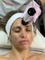 OXIGENEO FACIAL TRIPOLAR