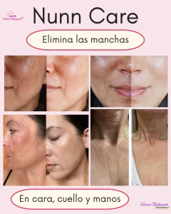 CREMA NUNN CARE - Shop Salud Integral 