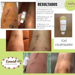 Wound healing gel - buy online