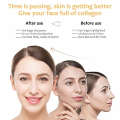 Masajeador Rejuvenedor Facial - iLion Store