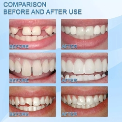 48 Dientes Kit Reparacion Postizo Provisorio Protesis Moldea - comprar online
