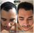 Imagem do Antes e depois