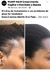 Antes e depois - comprar online