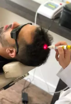 Sessão de Terapia Capilar Masculino na internet