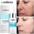 LANBENA-Tratamento De Acne Soro Facial, Anti Espinhas, Manchas - bunker.shop