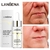 LANBENA-Tratamento De Acne Soro Facial, Anti Espinhas, Manchas - bunker.shop
