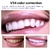 Mousse Clareamento Dental, Limpeza Profunda, Reparação de Manchas e pigmentação - comprar online