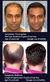 Crescimento Rápido Do Cabelo Óleo De Crescimento Do Cabelo Reparação Eficaz - comprar online