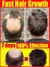 Crescimento Rápido Do Cabelo Óleo De Crescimento Do Cabelo Reparação Eficaz