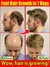 Crescimento Rápido Do Cabelo Óleo De Crescimento Do Cabelo Reparação Eficaz
