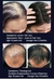 Crescimento Rápido Do Cabelo Óleo De Crescimento Do Cabelo Reparação Eficaz na internet