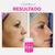 Clear Beauty | Clareador de Manchas, Melasma e Acne | Todos Tipos de Pele - loja online