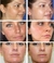 IBeaLee Whitening Sardas Cream, Removedor de manchas escuras de melasma, Removed - comprar online