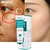 IBeaLee Whitening Sardas Cream, Removedor de manchas escuras de melasma, Removed na internet