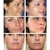 Imagem do IBeaLee Whitening Sardas Cream, Removedor de manchas escuras de melasma, Removed