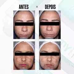 Glicointense Peel 30g - loja online