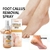 Imagem do Spray removedor de calos do pé para pedicure, Spray de pele morta, Essência es